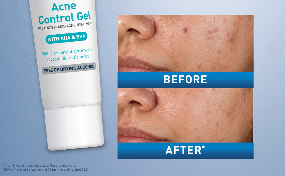 Cerave Gel Control Imperfecciones Con Ácido Salicílico 40 Ml Momento De Aplicación Día/noche Tipo De Piel Grasa